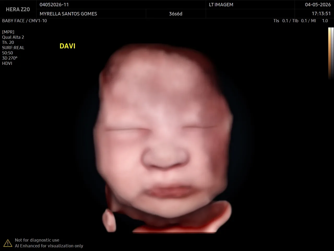 Lembrança Baby Click — bebê Davi